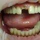 Dlaczego uvі snі złamane zęby - szczególne cechy tlumachennya
